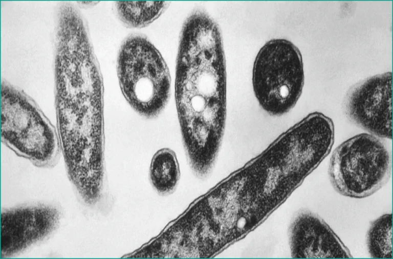 Second Death Reported in NYC Legionnaires’ Outbreak on Upper East Side