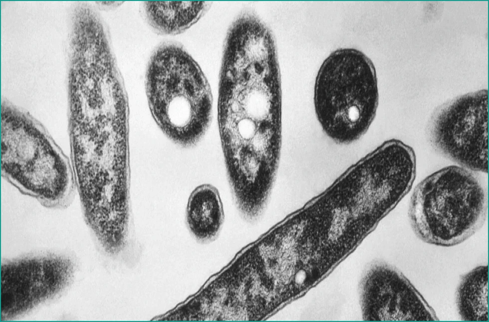 Second Death Reported in NYC Legionnaires’ Outbreak on Upper East Side