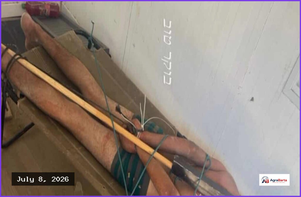 Rights Groups Say Viral Photo Confirms Israeli Torture of Detainees